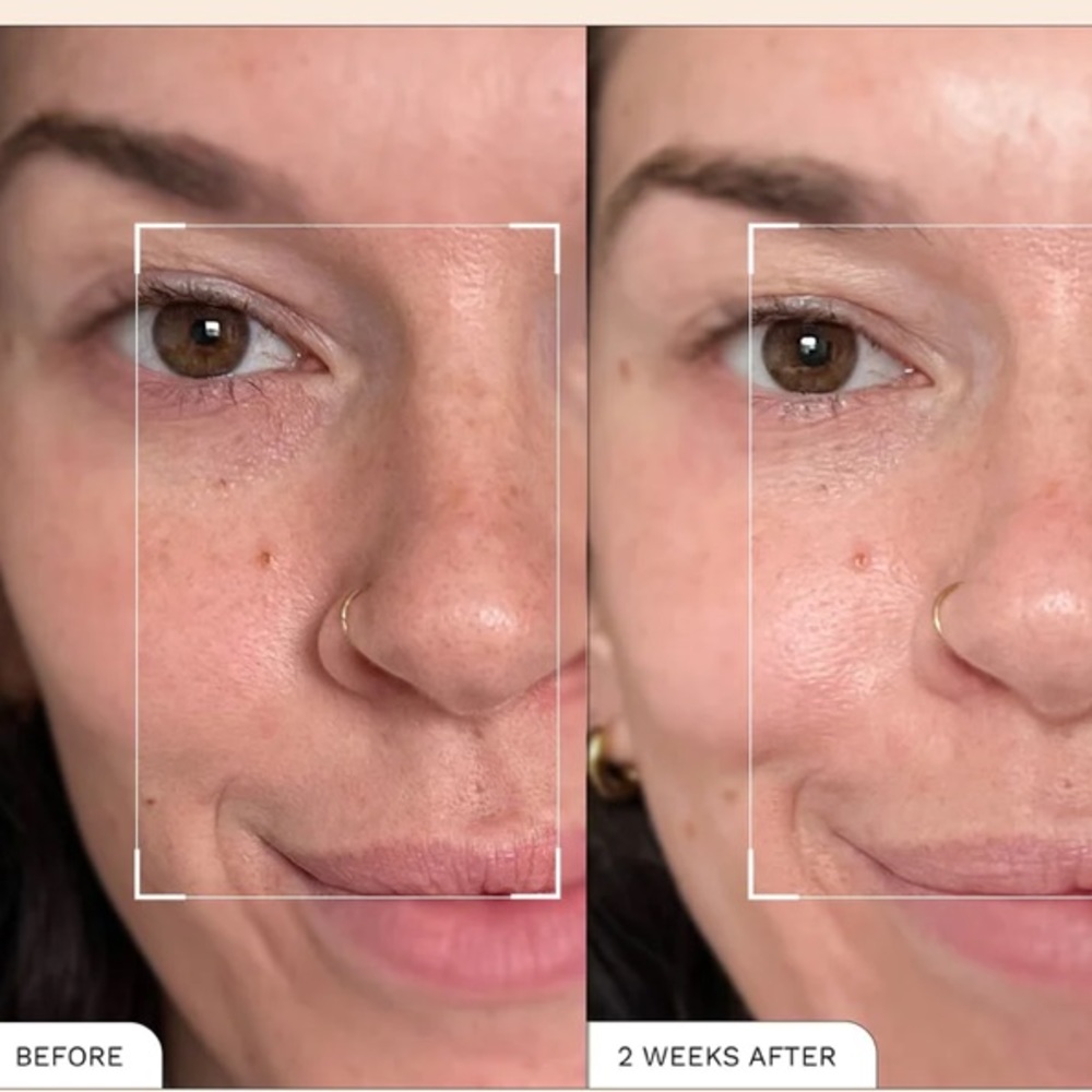 REN Clean Skincare Radiance Glow And Protect Vitamin C Serum - Picture 4 of 8